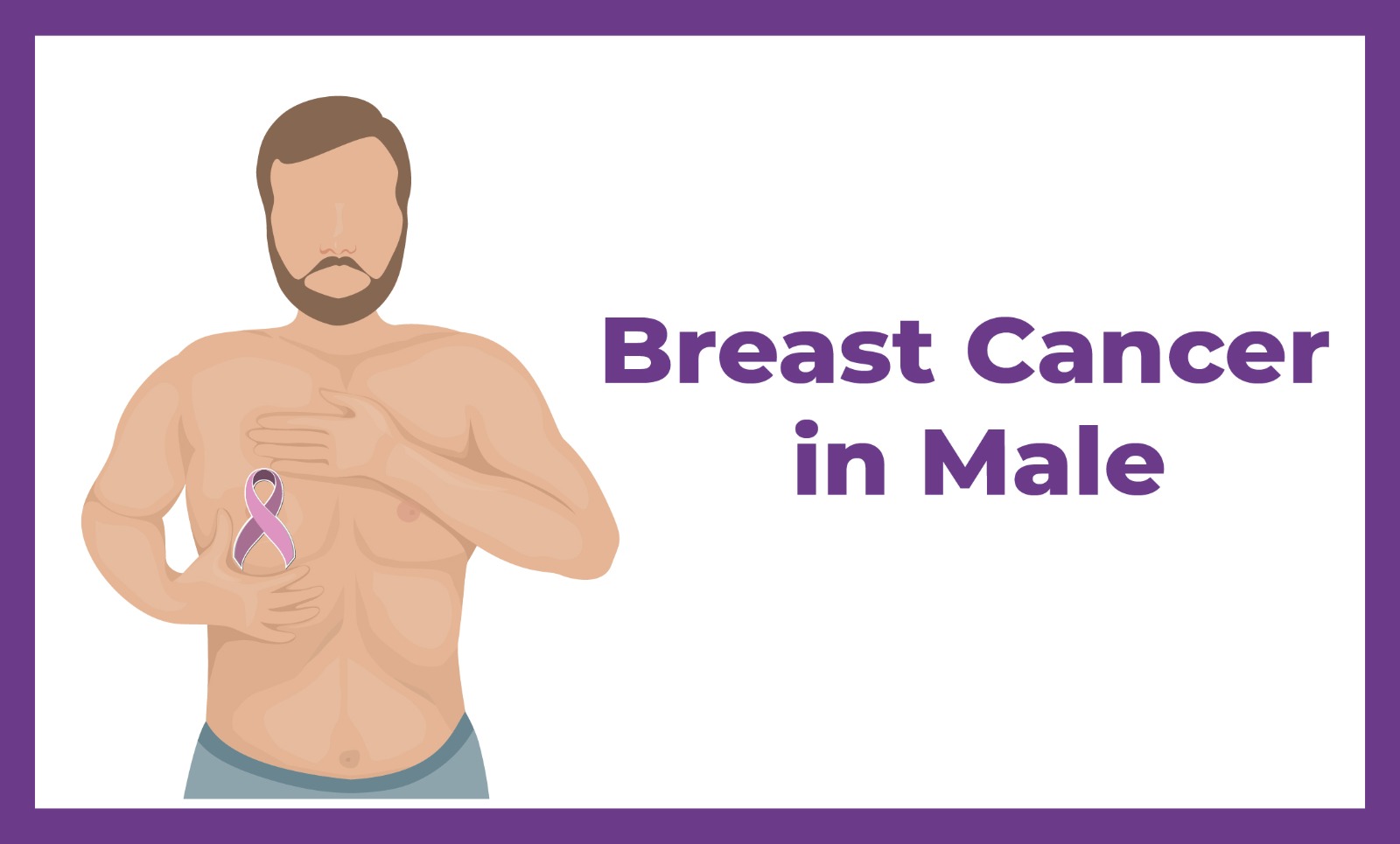 Breast Cancer in Male