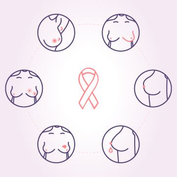 breast cancer symptoms